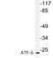 Activating Transcription Factor 3 antibody, LS-C176901, Lifespan Biosciences, Western Blot image 