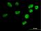 IGF Like Family Receptor 1 antibody, H00199746-B01P, Novus Biologicals, Immunofluorescence image 
