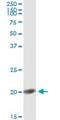 Fibroblast Growth Factor 1 antibody, H00002246-M02, Novus Biologicals, Immunoprecipitation image 