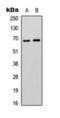 Epsin 3 antibody, orb393045, Biorbyt, Western Blot image 