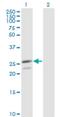 Peroxiredoxin 3 antibody, H00010935-M01, Novus Biologicals, Western Blot image 