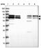 RUN And FYVE Domain Containing 1 antibody, PA5-58546, Invitrogen Antibodies, Western Blot image 