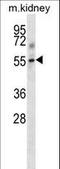 Transforming Growth Factor Beta Receptor 1 antibody, LS-C164589, Lifespan Biosciences, Western Blot image 