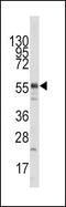 Lysine Acetyltransferase 5 antibody, PA5-11216, Invitrogen Antibodies, Western Blot image 