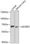 VICKZ family member 2 antibody, GTX33256, GeneTex, Western Blot image 