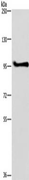 LLGL Scribble Cell Polarity Complex Component 1 antibody, TA351356, Origene, Western Blot image 