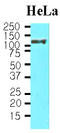 Heat Shock Protein Family H (Hsp110) Member 1 antibody, LS-C93751, Lifespan Biosciences, Western Blot image 