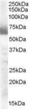 Cytochrome P450 Family 17 Subfamily A Member 1 antibody, GTX89365, GeneTex, Western Blot image 