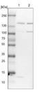 SPT5 Homolog, DSIF Elongation Factor Subunit antibody, NBP1-83508, Novus Biologicals, Western Blot image 