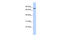 Zinc Finger Protein 333 antibody, 25-547, ProSci, Western Blot image 