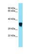 Sorting Nexin 15 antibody, orb331338, Biorbyt, Western Blot image 