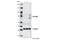 Frizzled Class Receptor 6 antibody, 5158S, Cell Signaling Technology, Western Blot image 