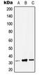 Zinc Finger Matrin-Type 3 antibody, LS-C353842, Lifespan Biosciences, Western Blot image 
