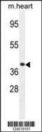 G Protein Subunit Alpha 15 antibody, 55-209, ProSci, Western Blot image 