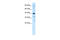 Zinc Finger And SCAN Domain Containing 31 antibody, 28-421, ProSci, Enzyme Linked Immunosorbent Assay image 