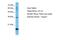 C-C Motif Chemokine Ligand 18 antibody, PA5-46817, Invitrogen Antibodies, Western Blot image 