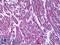 Malate Dehydrogenase 1 antibody, LS-B6378, Lifespan Biosciences, Immunohistochemistry paraffin image 