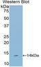 Semaphorin 3A antibody, LS-C315028, Lifespan Biosciences, Western Blot image 