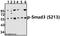 SMAD Family Member 3 antibody, A00059S213, Boster Biological Technology, Western Blot image 