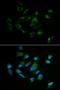 Tyrosinase antibody, orb48569, Biorbyt, Immunofluorescence image 