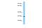 Family With Sequence Similarity 122B antibody, A13776, Boster Biological Technology, Western Blot image 