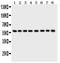 Purinergic receptor antibody, PB9303, Boster Biological Technology, Western Blot image 