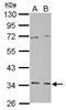 Geranylgeranyl Diphosphate Synthase 1 antibody, NBP2-16652, Novus Biologicals, Western Blot image 