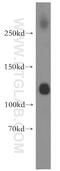 Solute Carrier Family 12 Member 5 antibody, 19565-1-AP, Proteintech Group, Western Blot image 