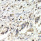 BUB1 Mitotic Checkpoint Serine/Threonine Kinase B antibody, 18-086, ProSci, Immunohistochemistry paraffin image 