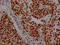 Interleukin Enhancer Binding Factor 3 antibody, CSB-RA289890A0HU, Cusabio, Immunohistochemistry paraffin image 