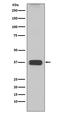 Arginase 1 antibody, M01106-1, Boster Biological Technology, Western Blot image 