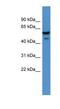 Carbohydrate Sulfotransferase 11 antibody, NBP1-68912, Novus Biologicals, Western Blot image 