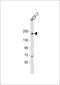 Ubiquitin Specific Peptidase 32 antibody, 61-181, ProSci, Western Blot image 