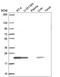 ADP Ribosylation Factor Like GTPase 1 antibody, HPA062656, Atlas Antibodies, Western Blot image 