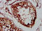 Nuclear Receptor Binding SET Domain Protein 2 antibody, LS-C673691, Lifespan Biosciences, Immunohistochemistry paraffin image 