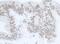 DExH-Box Helicase 9 antibody, NB110-40579, Novus Biologicals, Immunohistochemistry paraffin image 