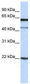 Megakaryocyte And Platelet Inhibitory Receptor G6b antibody, TA339555, Origene, Western Blot image 