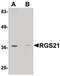 Regulator Of G Protein Signaling 21 antibody, PA5-20760, Invitrogen Antibodies, Western Blot image 