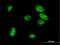 Mesenchyme Homeobox 1 antibody, H00004222-M07, Novus Biologicals, Immunofluorescence image 