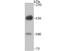 Desmoglein 2 antibody, A02035-2, Boster Biological Technology, Western Blot image 