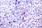 Activating Transcription Factor 2 antibody, LS-C175925, Lifespan Biosciences, Immunohistochemistry frozen image 