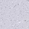 Charcot-Leyden Crystal Galectin antibody, HPA041751, Atlas Antibodies, Immunohistochemistry paraffin image 