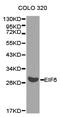 Eukaryotic Translation Initiation Factor 6 antibody, LS-C192810, Lifespan Biosciences, Western Blot image 