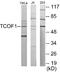 Treacle Ribosome Biogenesis Factor 1 antibody, EKC1796, Boster Biological Technology, Western Blot image 