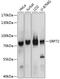 Signal Recognition Particle 72 antibody, 13-852, ProSci, Western Blot image 