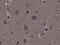 Ribosomal Protein S6 Kinase A1 antibody, MA5-24701, Invitrogen Antibodies, Immunohistochemistry paraffin image 