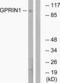 G Protein Regulated Inducer Of Neurite Outgrowth 1 antibody, LS-C119985, Lifespan Biosciences, Western Blot image 