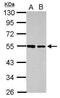 Dihydrouridine Synthase 2 antibody, GTX121407, GeneTex, Western Blot image 