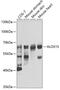 Arachidonate 15-Lipoxygenase antibody, A01222, Boster Biological Technology, Western Blot image 