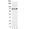 Transient Receptor Potential Cation Channel Subfamily V Member 3 antibody, R31084, NSJ Bioreagents, Western Blot image 